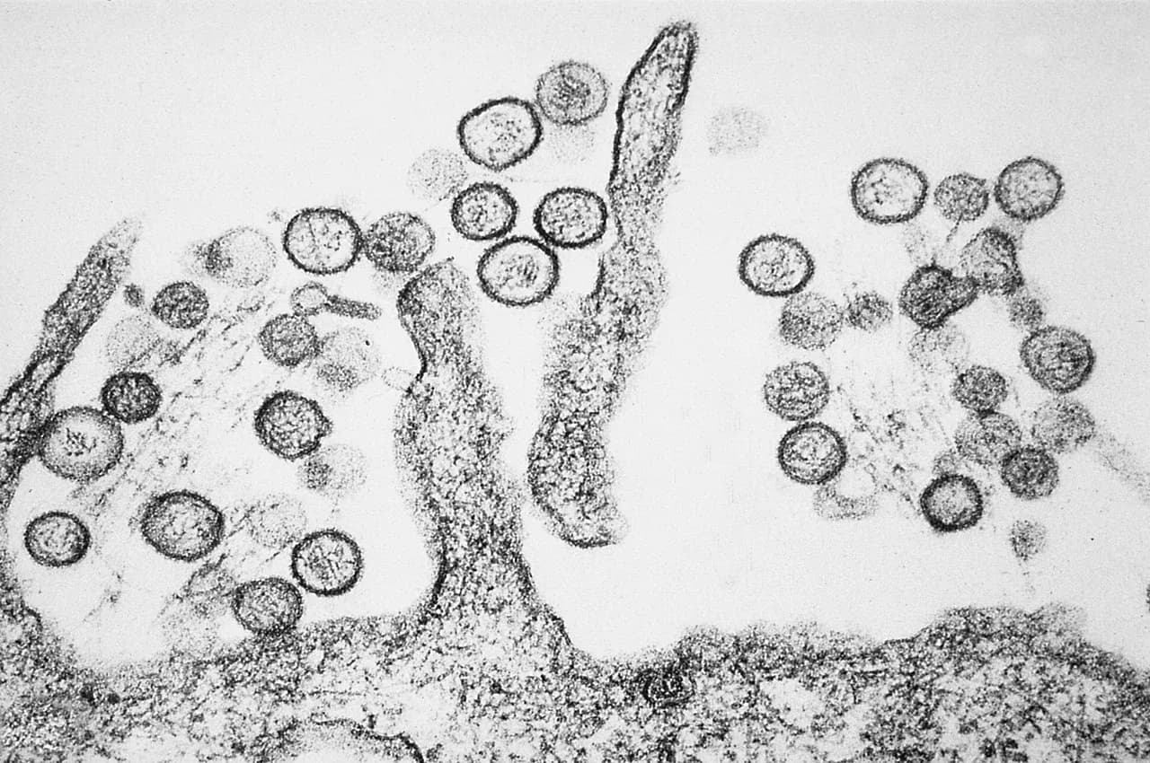 Transmissionselektronmikrografi af Sin Nombre-hantavirus. Hantavirus, der kan give hantavirus-lungesyndrom (HPS), spredes via gnaveres efterladenskaber.