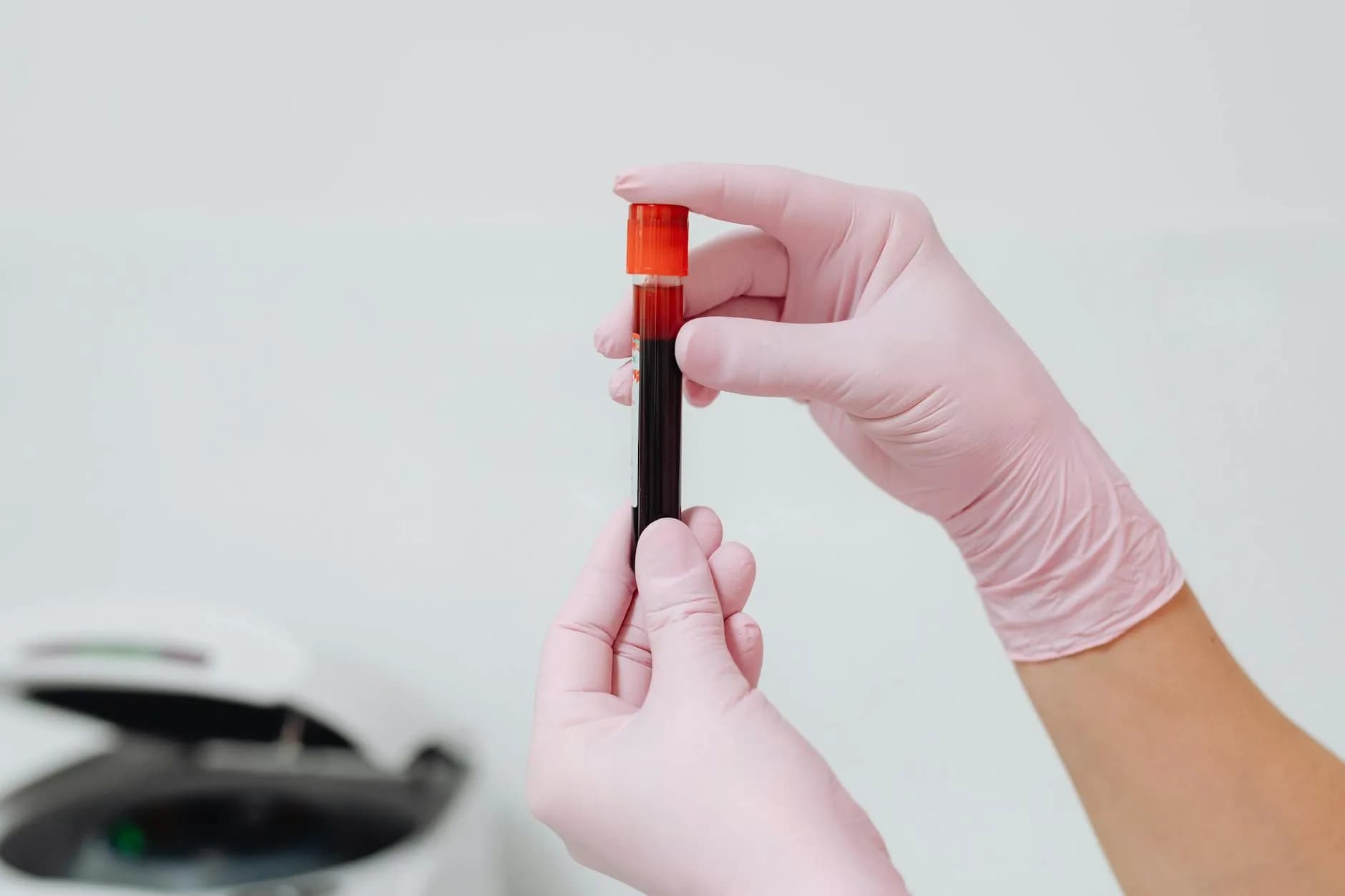 Et tæt billede af handskeklædte hænder, der holder en blodprøve i et test-/reagensglas. Velegnet til artikler om laboratoriearbejde, prøvetagning og sundhedsforskning.