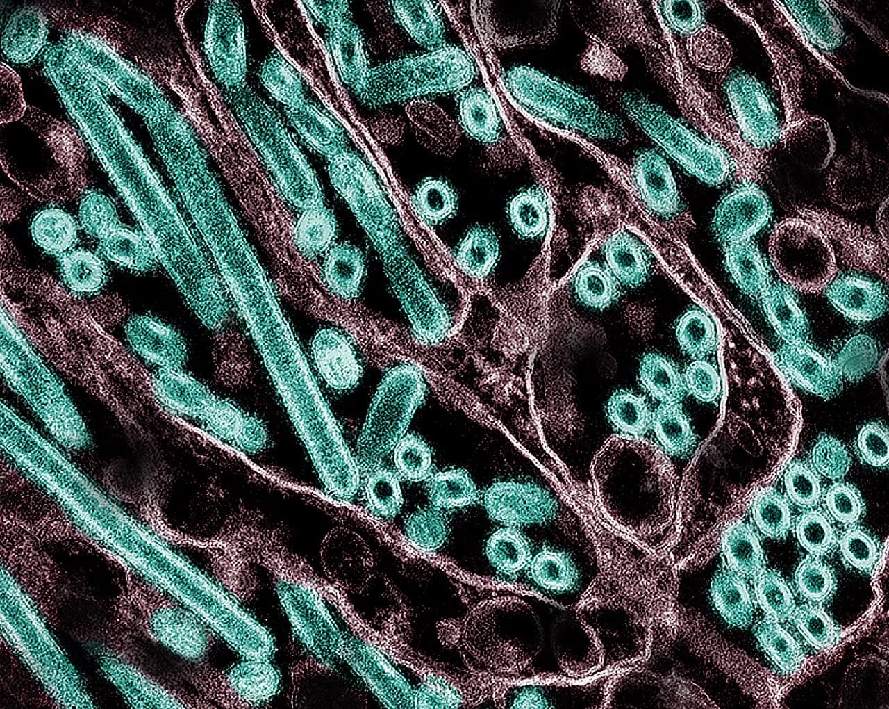 Farvet transmissionsmikrografi af H5N1 fugleinfluenza A-viruspartikler (grønne), dyrket i MDCK-celler. Mikroskopi er udført af CDC, og billedet er repositioneret og farvelagt af NIAID.
