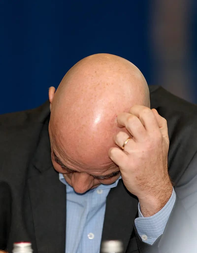 Bald man scratching his head