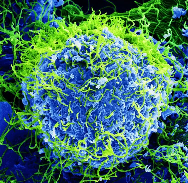 Electron microscope image of a cell infected by Ebola virus