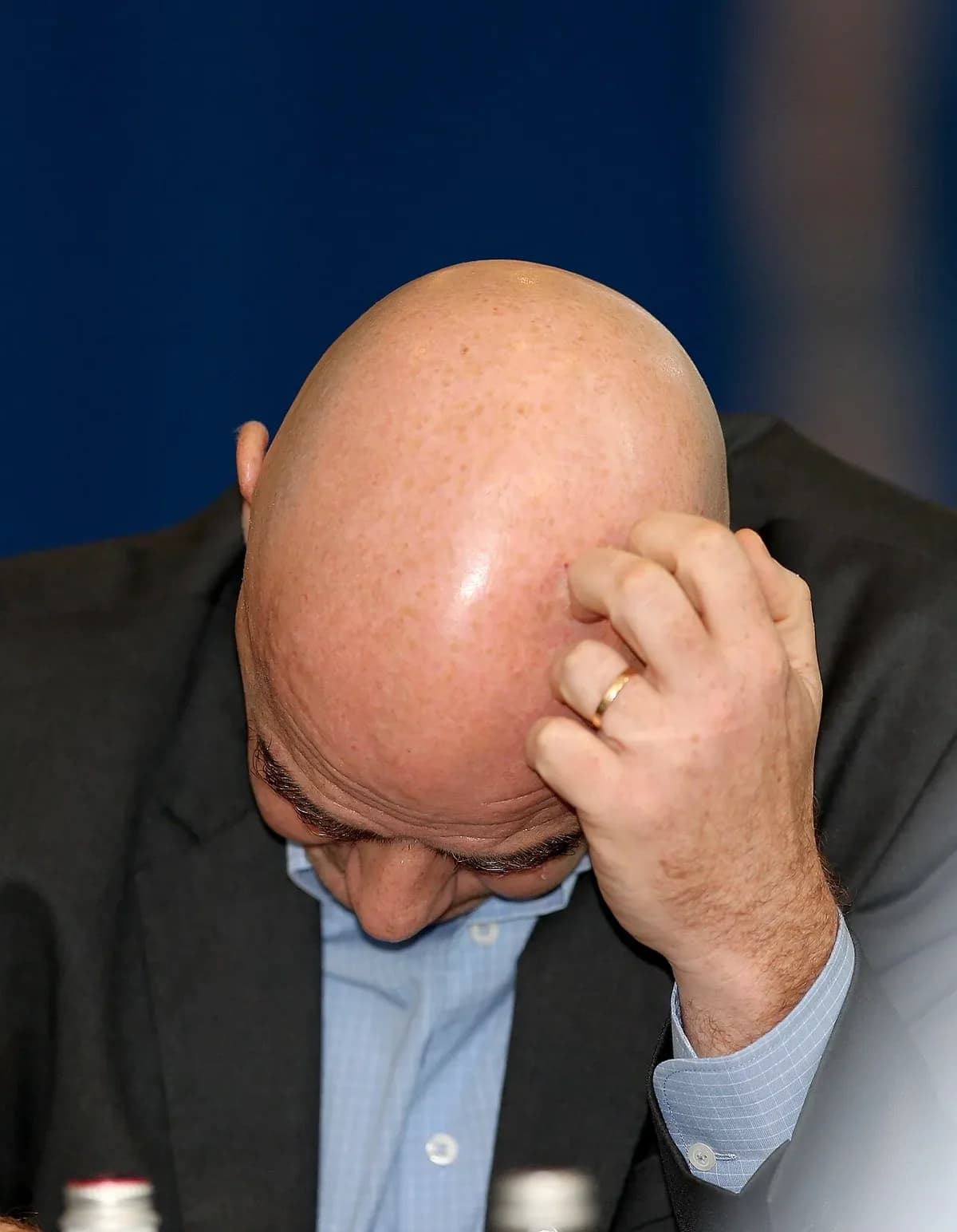 Bald man scratching head looking down